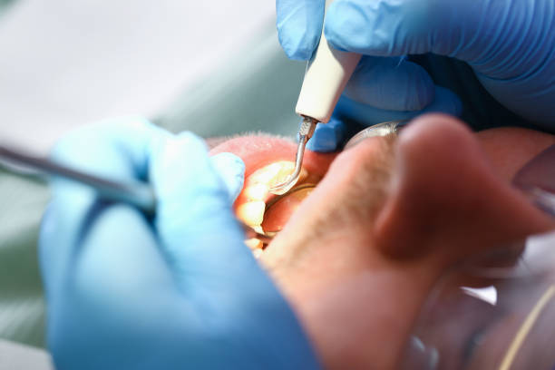 Best Weekend Emergency Dental Services in Saegertown, PA