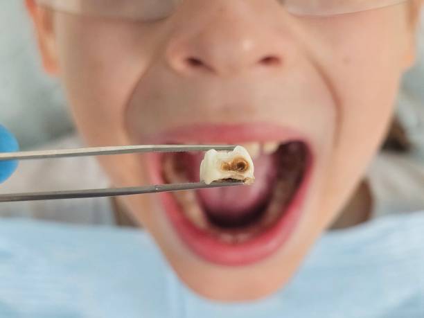 Best Emergency Orthodontic Repairs in Saegertown, PA